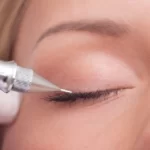 Коррекция межресничного пространства